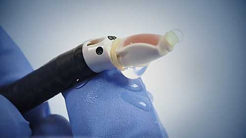 经气管镜超声引导针吸活检：准备设备