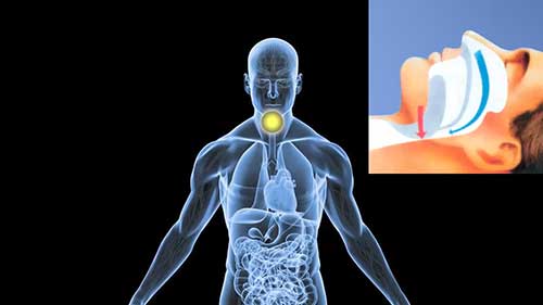 什么是睡眠呼吸暂停