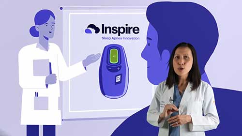 Inspire睡眠治疗系统