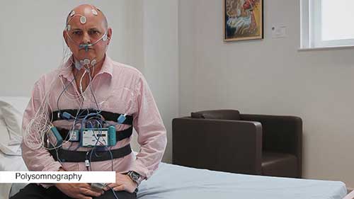 睡眠呼吸障碍：诊断