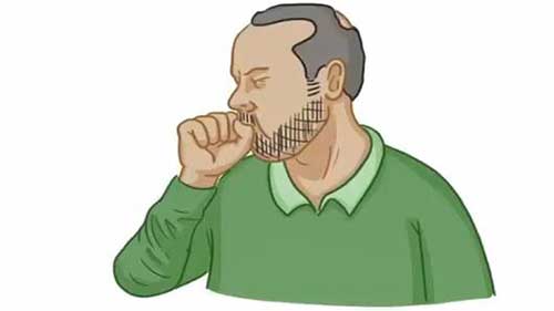 呼吸窘迫综合征基本概况