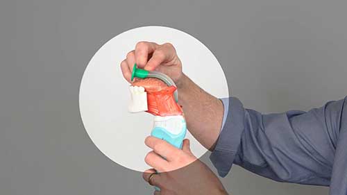 口咽通气道插入指导