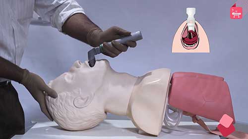 气管插管操作演示