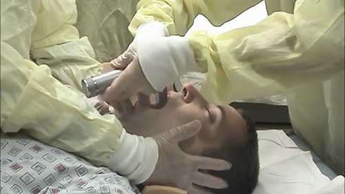 快速诱导插管在急诊中的应用