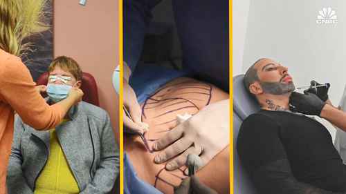 为什么整形越来越多