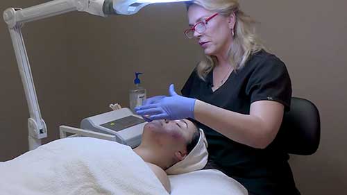 如何利用高频去除痤疮