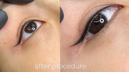 如何做永久眼线