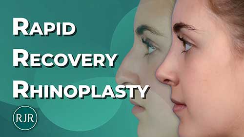 鼻整形快速恢复