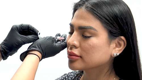 完美的丰面颊术