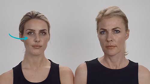 哪种眼部手术让你看起来更年轻