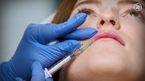 嘴唇注射填充