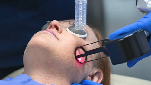 二氧化碳点阵激光的作用