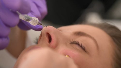 鼻子和下巴填充