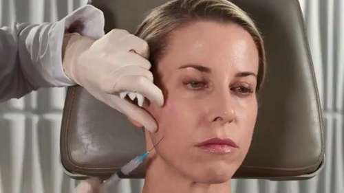 舒颜萃童颜针注射