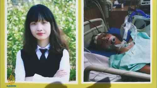 整形外科：美容成本