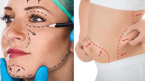 整形美容行业大幅增长