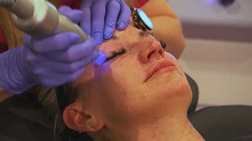 最佳无创医疗美容技术