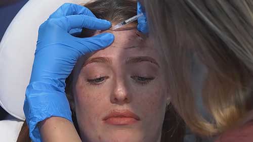 肉毒素注射剂量指南