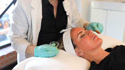 化学剥脱后的皮肤变化