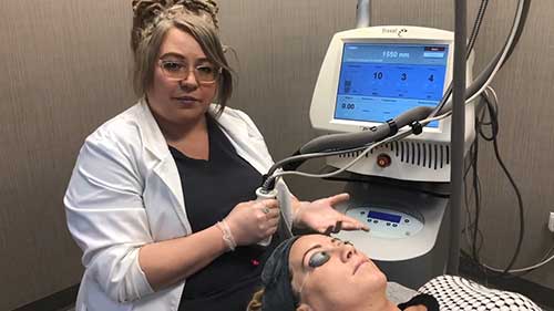 飞梭镭射激光磨皮体验