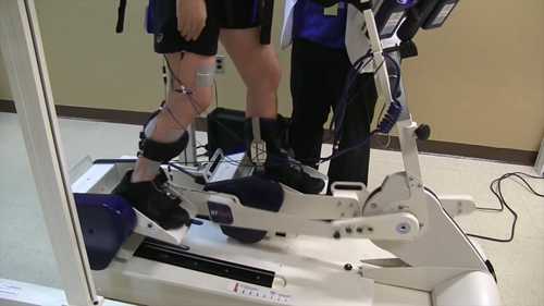 卒中后康复：FES疗法