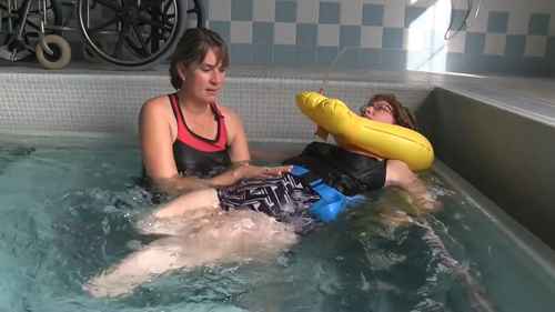 先天性四肢切断症患者的康复治疗