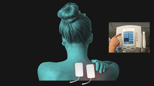 经皮神经电刺激疗法