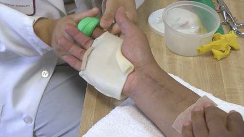 创伤后康复：手部康复训练