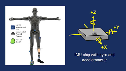 监测假肢安装和校准的分析系统
