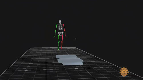 植入式骨整合假肢