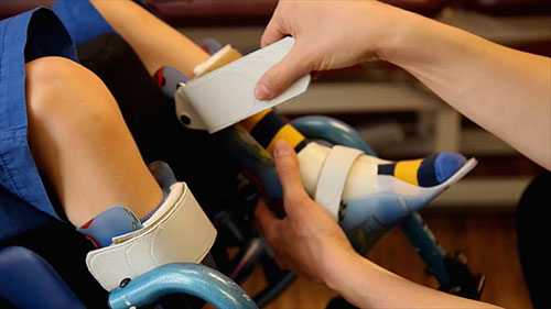 如何制造踝足矫形器