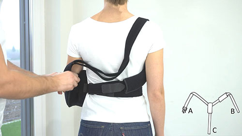 如何穿戴肩外展矫形器