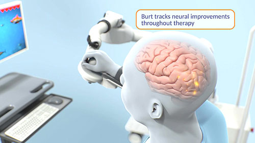 Burt上肢康复机器人