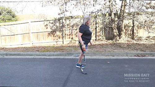 如何用假肢跑步