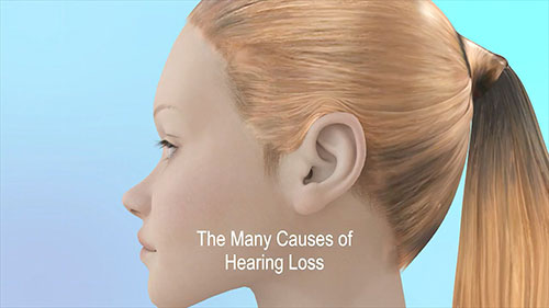 听力损失的病因