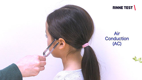 听力检测音叉试验