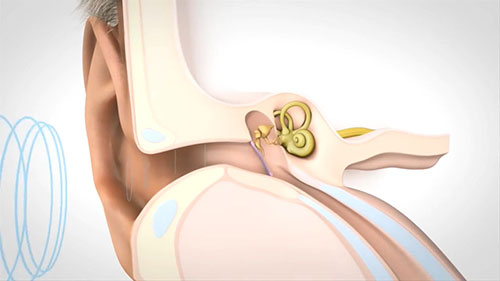 感觉神经性耳聋