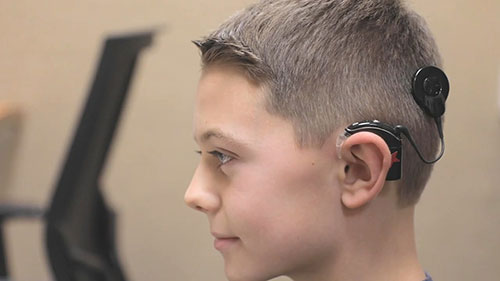 儿童听力筛查的重要性