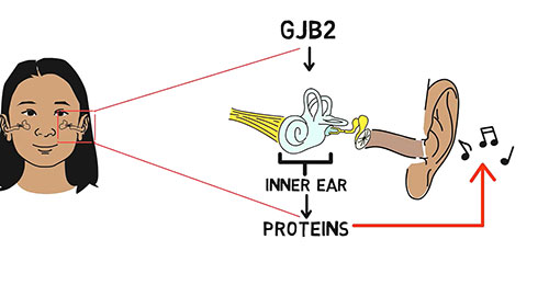 听力损失与遗传