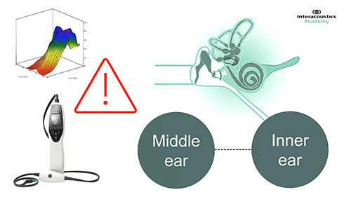 骨导听性脑干反应测试