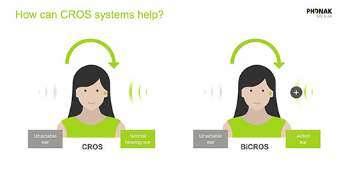 单侧全聋的解决方法