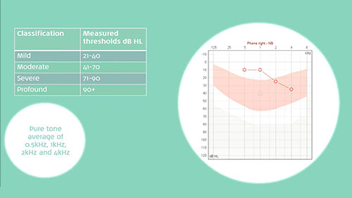 如何诊断儿童听力损失
