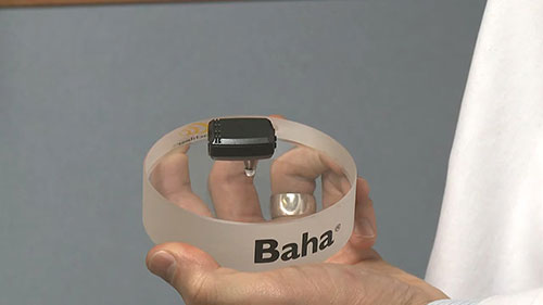 听力损失的治疗方法与进展