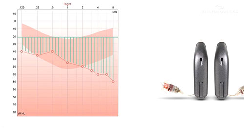为什么要进行真耳测试