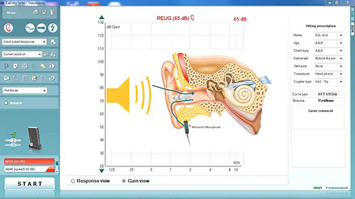 如何进行真耳测试