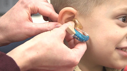 为儿童佩戴助听器和耳模