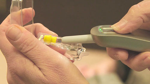 深耳道式助听器的佩戴过程