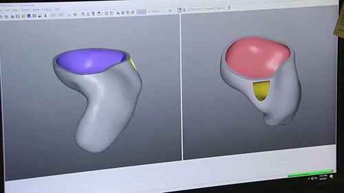 助听器耳模通气孔