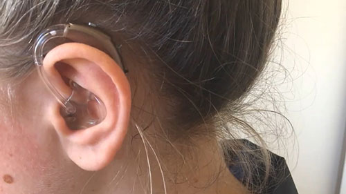 助听器耳膜的安装