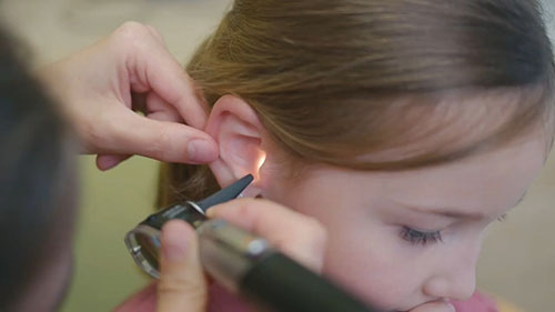 儿童耳印模制取